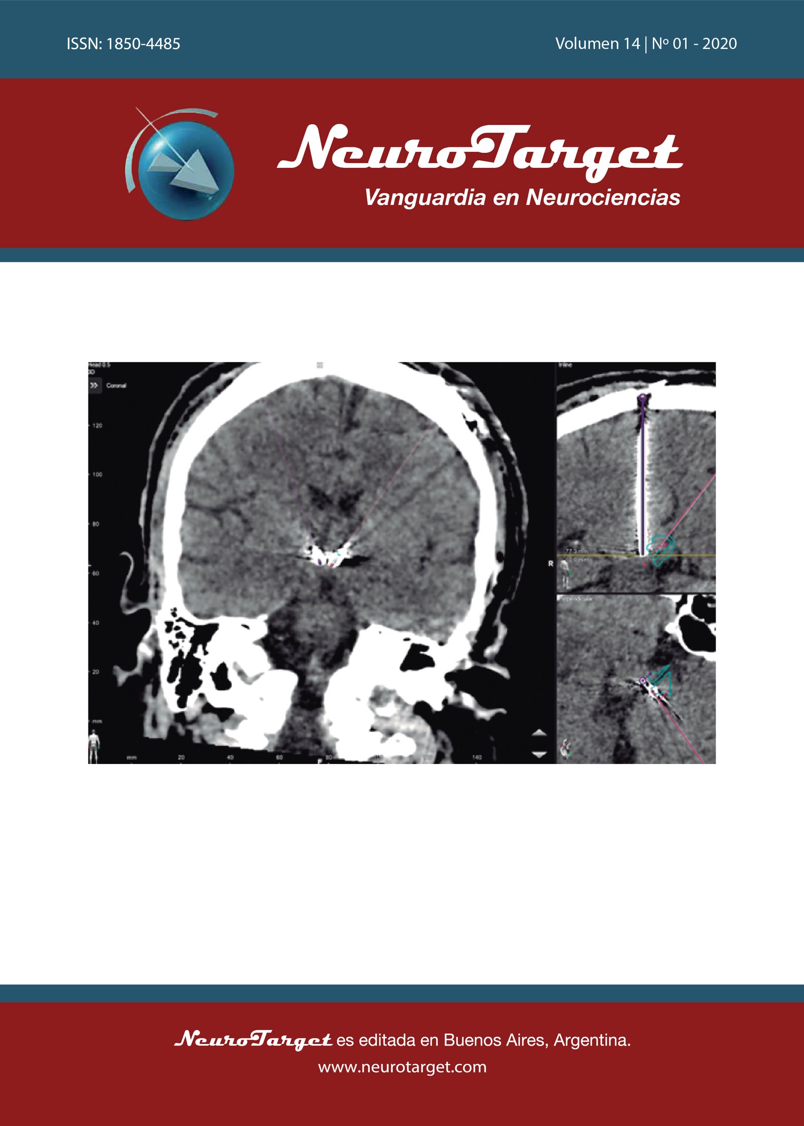 					View Vol. 14 No. 1 (2020): NeuroTarget
				